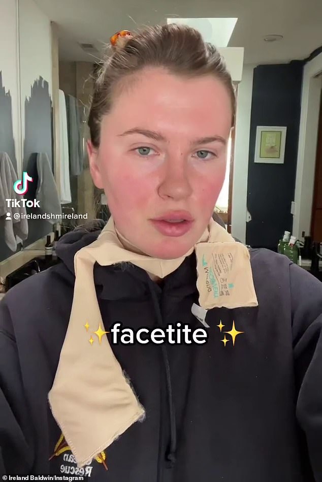 Honesto: Ireland Baldwin habla sobre por qué se someterá a FaceTite, un procedimiento cosmético mínimamente invasivo comparable a un estiramiento facial quirúrgico, este mes